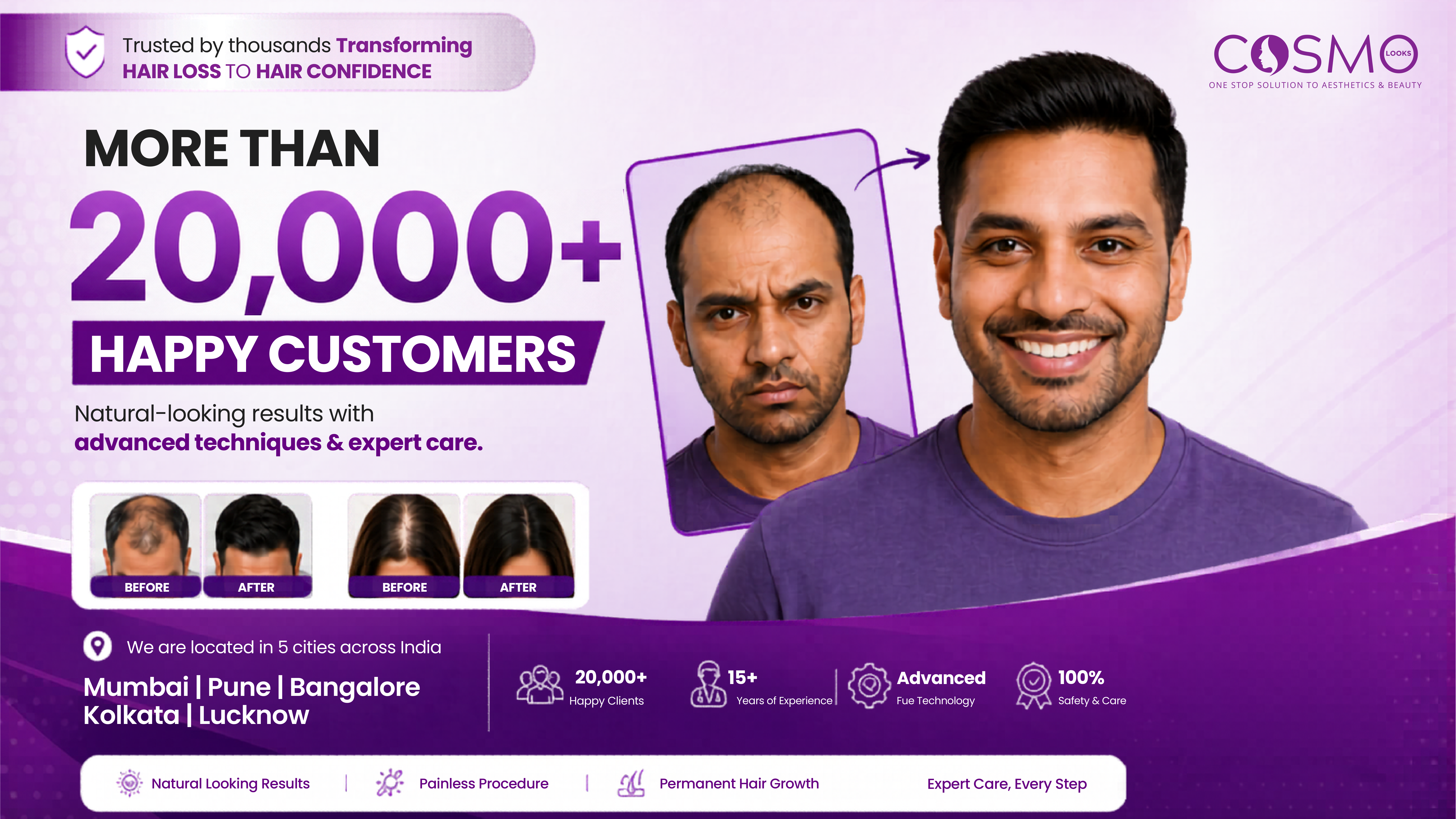 20,000+ Happy Customers — Hair Transplant