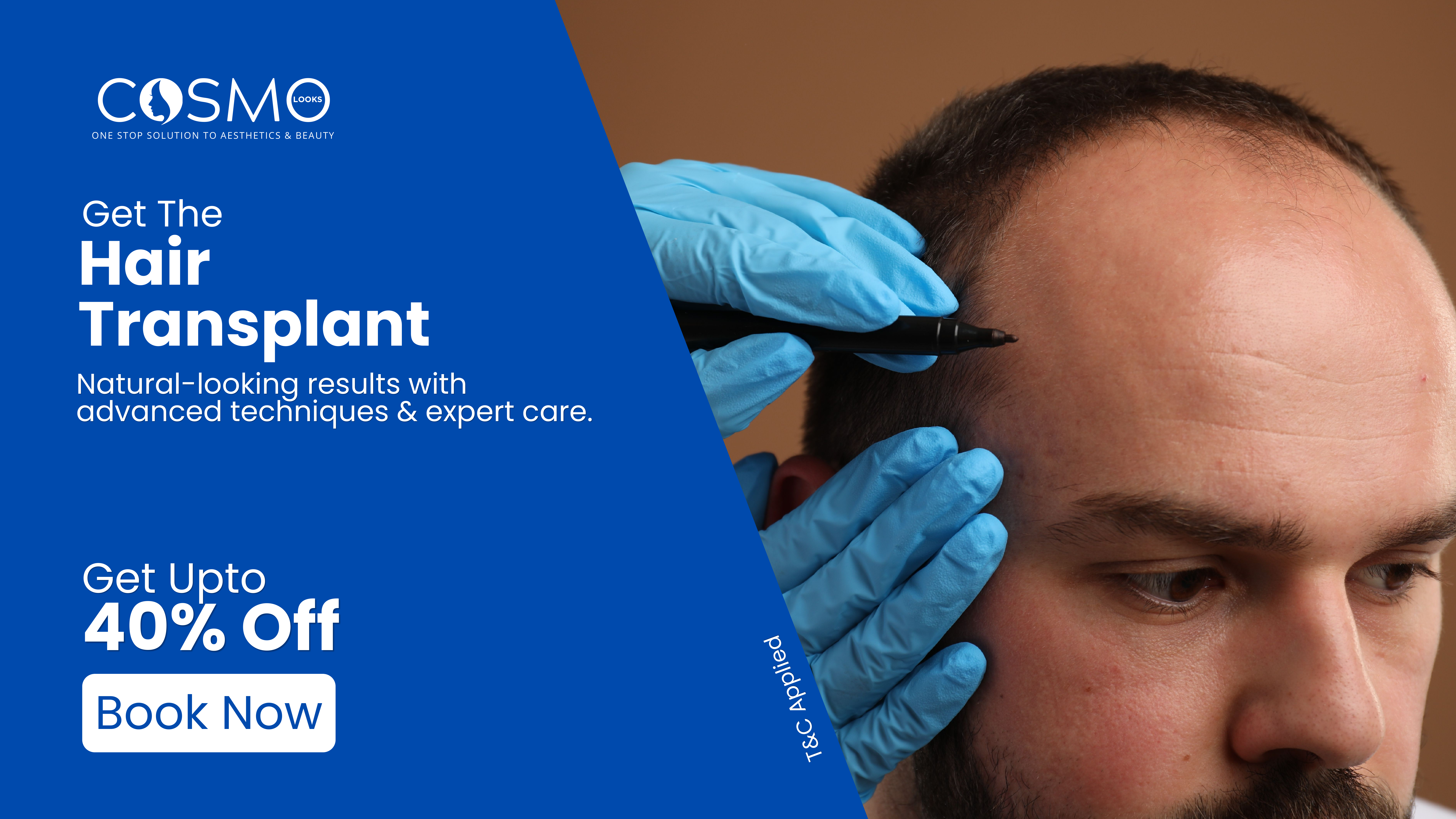 Hair Transplant — Book Now